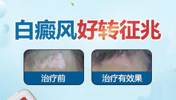 308激光治疗白斑变成粉红色又变成黑色正常吗