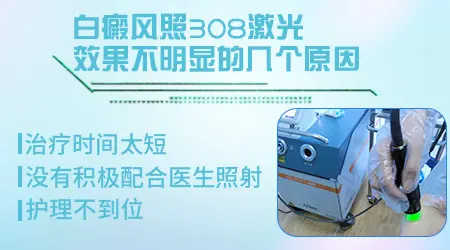 白癜风308激光照光两个月没效果那怎么办