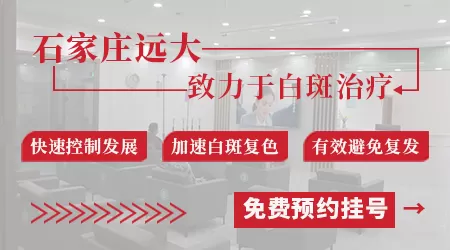 遮盖白斑小妙招