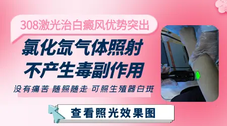 埋线能治疗白癜风吗