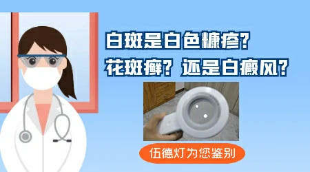 手指关节处有白斑图片