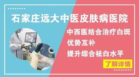 白癜风检查后同形反应阳性是什么意思