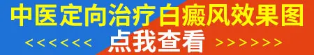 中医治疗白癜风都有哪些方法