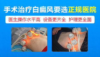 白癜风吸泡可以用别人皮肤吗