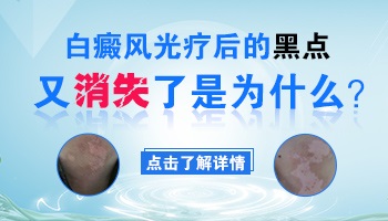 白癜风长了黑点又消失了怎么回事