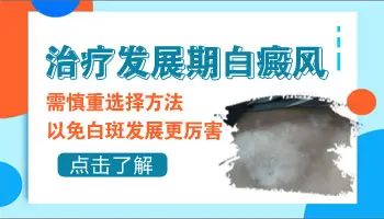 眼角部位白斑扩散了