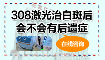 308激光治白斑后有遗症吗