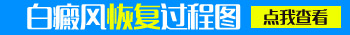 白癜风照光10次后发红是有效果吗
