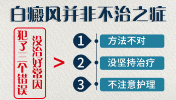 肛门和阴道口有白癜风能好吗