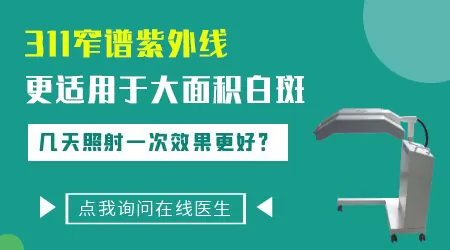 311光疗照白癜风多久一个疗程