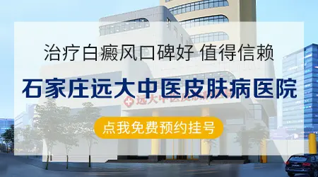 生姜能治白癜风效果好吗