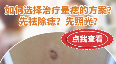 晕痣一定要把痣点了才能好转吗