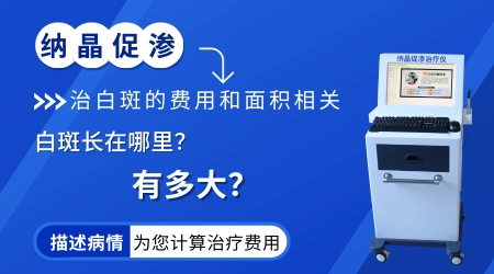 纳晶治疗白癜风的收费标准是多少
