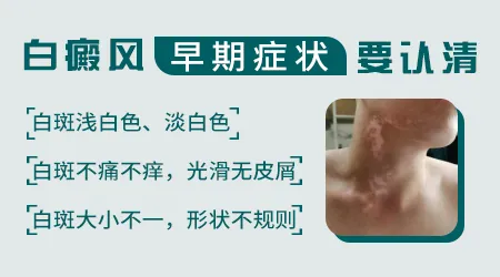 白癜风图片鉴别和初诊 不用跑医院先看图判断