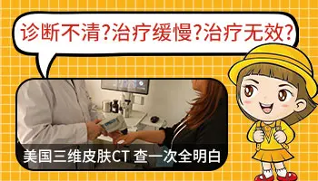 白癜风一直在治疗效果不明显