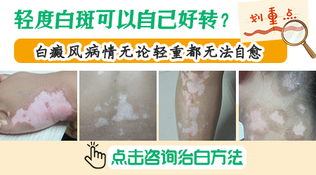 脸上出现小白斑是怎么回事