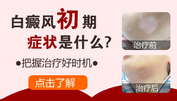 脖子上白癜风初期症状图片