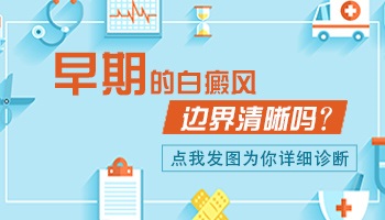 白癜风是不是边缘很明显 早期白癜风症状