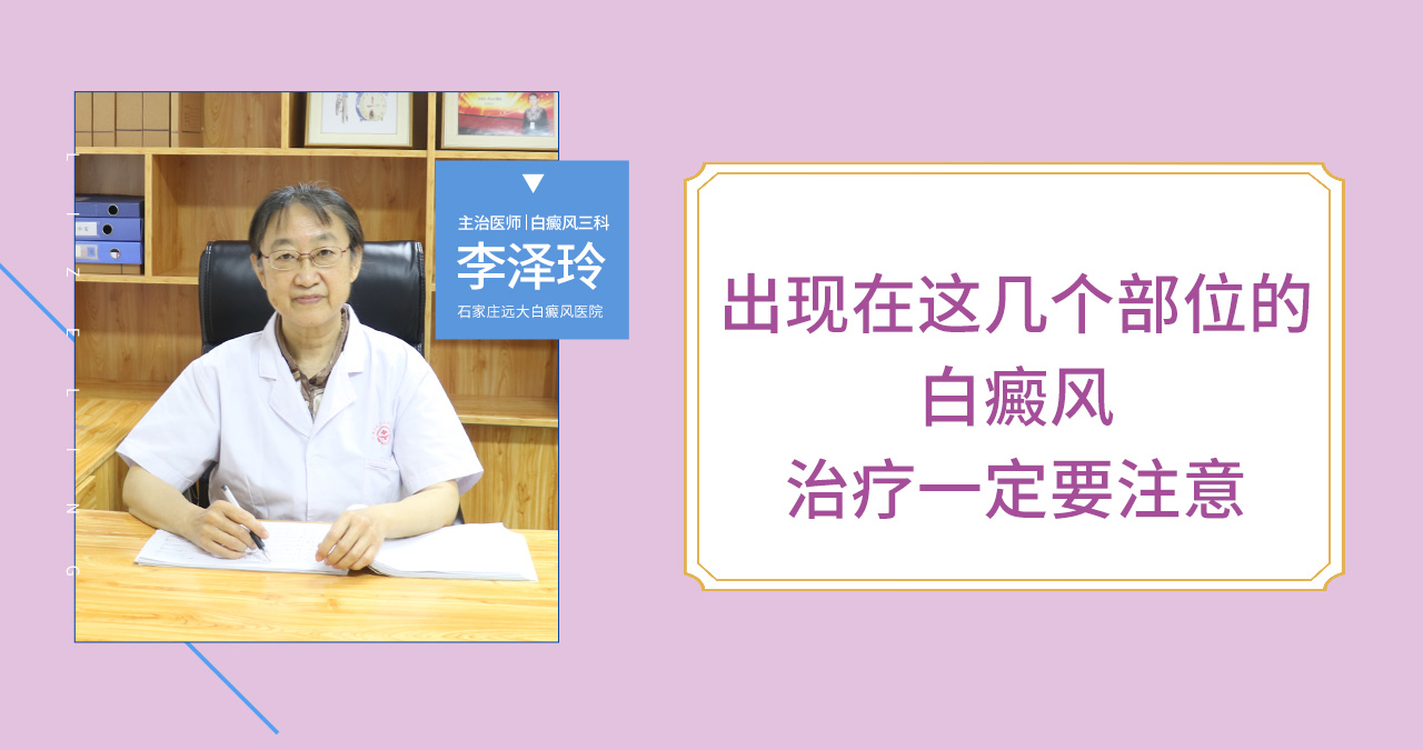 出现在这几个部位的白癜风，治疗一定要注意