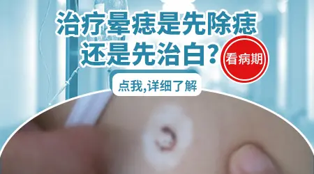 晕痣切除三年后白斑有扩大