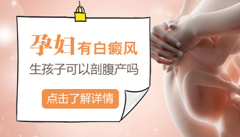 有白癜风能剖腹产吗
