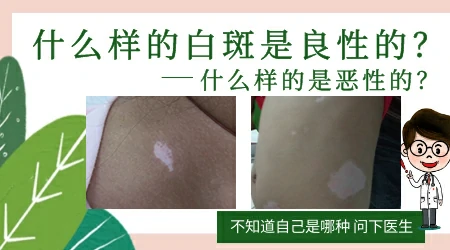 腿上好多白点是白癜风图片