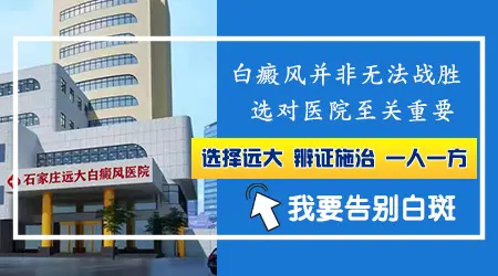 中医治白癜风的功效怎么样 收费贵不贵