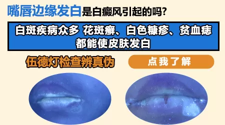 口唇有白点图片
