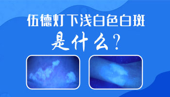 伍德灯检查白斑准确还是皮肤CT准确