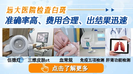 孩子脸上长白斑去医院要做哪些检查