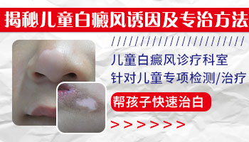 扩散期的儿童白癜风如何治疗