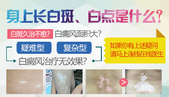 肛周白斑看什么科 为什么会白一块