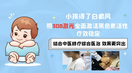 儿童白癜风不想长期用药还有什么温和的方法