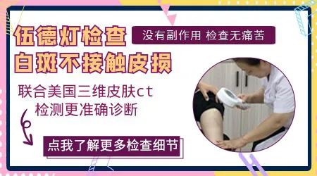 伍德灯检查白癜风对皮肤有伤害吗