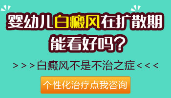 婴幼儿白癜风怎么治疗才安全