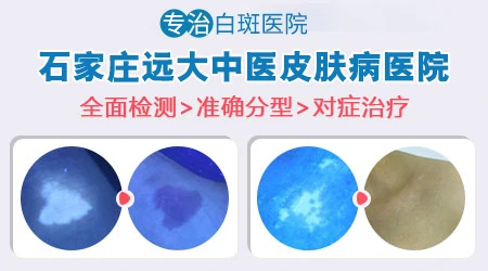 腿上和胳膊上出现一小块一小块的白怎么回事