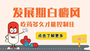 儿童脸上有一小块白癜风能治好吗