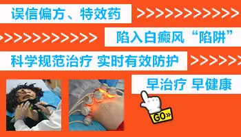 有没有什么偏方能治好白癜风