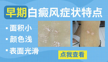 白癜风早期会是对称吗