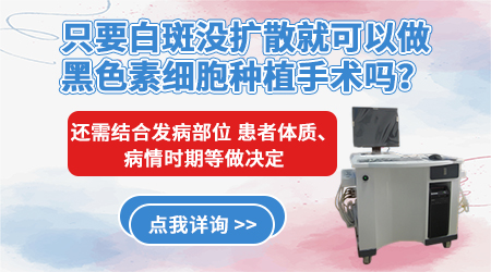 小面积的白癜风多久会变成大面积