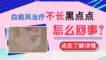 白癜风患者照光后不长出黑色素怎么回事