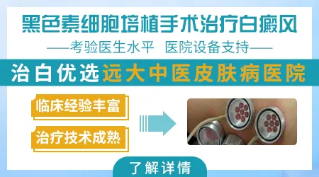 手部白癜风做植皮手术成功率高吗