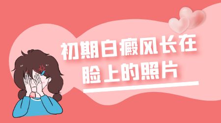 脸部白癜风发病初期的图片