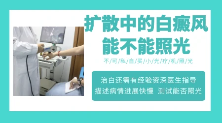 白癜风扩散期能正常做308激光治疗吗