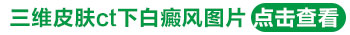 8个月宝宝脸上为什么有一小块白