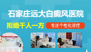 手指根部白癜风用什么药好