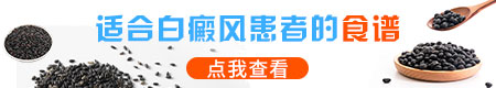 白癜风偶尔一次喝啤酒可以吗