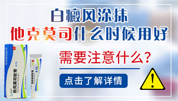 身上好几处白癜风可以长期用他克莫司吗