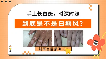 手上长了一圈白不知道是什么