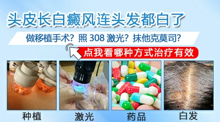 白癜风好以后白发能变黑吗